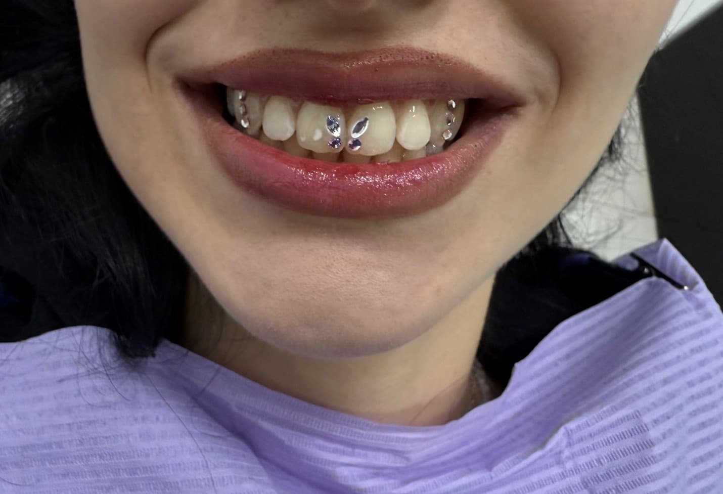 Tooth piercing and dental gem application
